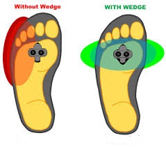 hotfoot