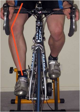 Uneven loading on the knee